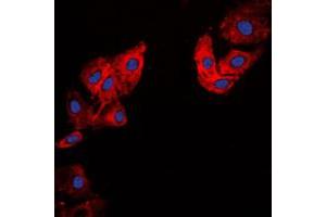Immunofluorescent analysis of Collagen 5 alpha 1 staining in HeLa cells. (COL5A1 antibody  (Center))
