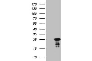 Western Blotting (WB) image for anti-ATP-Binding Cassette, Sub-Family C (CFTR/MRP), Member 5 (ABCC5) antibody (ABIN2715615) (ABCC5 antibody)