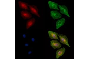 Phospho-MAP3K8/COT (Ser443) Antibody staining A549 cells(heat shock treatment) by IF/ICC.