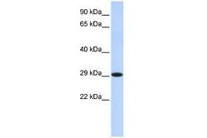 Image no. 1 for anti-Hydroxysteroid (17-Beta) Dehydrogenase 14 (HSD17B14) (C-Term) antibody (ABIN6741399) (HSD17B14 antibody  (C-Term))