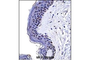 CSRP2 Antibody (Center) ((ABIN657989 and ABIN2846936))immunohistochemistry analysis in formalin fixed and paraffin embedded human skin tissue followed by peroxidase conjugation of the secondary antibody and DAB staining. (CSRP2 antibody  (AA 68-96))