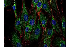 Immunocytochemistry staining of Sos in human primary fibroblasts using anti-Sos (SOS-01, green). (Sos antibody)