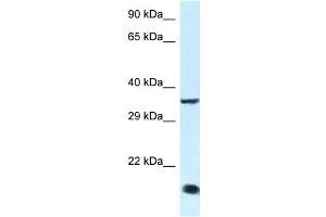 WB Suggested Anti-Klf3 Antibody   Titration: 1.