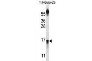 Western Blotting (WB) image for anti-Prolactin Releasing Hormone (PRLH) antibody (ABIN2997173) (PRLH antibody)