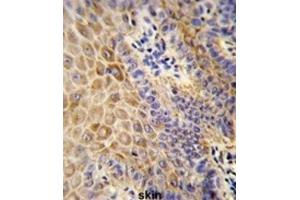Immunohistochemistry (IHC) image for anti-Gc antibody (ABIN3003972) (Gc antibody)
