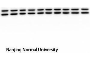 Western Blot (WB) analysis: Please contact us for more details. (ERK1/2 antibody  (pTyr204))
