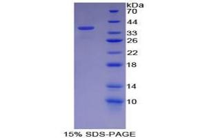 SDS-PAGE analysis of Mouse Neurofibromin 2 Protein.