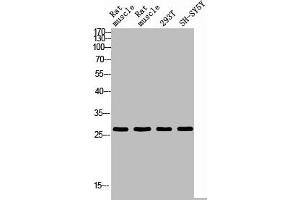 Western blot analysis of RAT-MUSLE RAT-SPLEEN 293T SH-SY5Y using IL26 antibody. (IL-26 antibody  (Internal Region))