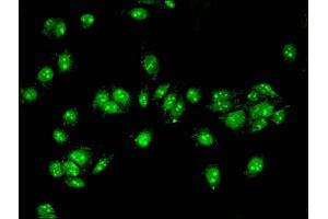 Immunofluorescent analysis of HepG2 cells using ABIN7143187 at dilution of 1:100 and Alexa Fluor 488-congugated AffiniPure Goat Anti-Rabbit IgG(H+L) (ACAD11 antibody  (AA 225-388))