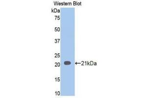 Western Blotting (WB) image for anti-Involucrin (IVL) (AA 6-156) antibody (ABIN1859461)