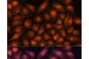 Immunofluorescence analysis of HeLa cells using DDX31 Polyclonal Antibody at dilution of 1:100. (DDX31 antibody)