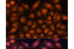 Immunofluorescence analysis of HeLa cells using DDX31 Polyclonal Antibody at dilution of 1:100. (DDX31 antibody)