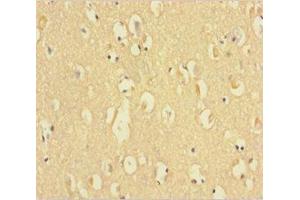 Immunohistochemistry of paraffin-embedded human brain tissue using ABIN7154647 at dilution of 1:100 (C9ORF72 antibody  (AA 138-430))