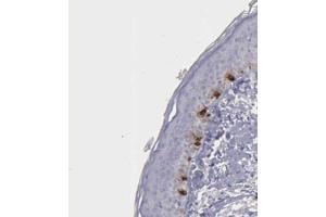 Immunohistochemical staining (Formalin-fixed paraffin-embedded sections) of human skin shows distinct cytoplasmic positivity in melanocytes with TYRP1 polyclonal antibody . (Tyrosinase-Related Protein 1 antibody  (AA 257-377))