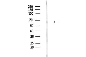 Western blot analysis of lysates from Hela cells(LPS,4h treatment), using Phospho-SHP1 (Tyr564) Antibody at 1/1000 dilution.