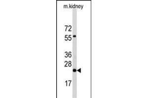 Western blot analysis of anti-PEMT Antibody (N-term) Pab (ABIN650614 and ABIN2844055) in mouse kidney tissue lysates (35 μg/lane). (PEMT antibody  (N-Term))