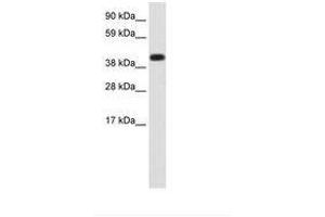 Image no. 1 for anti-Heat Shock 70kDa Protein 1A (HSPA1A) (AA 286-335) antibody (ABIN202621) (HSP70 1A antibody  (AA 286-335))