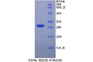 SDS-PAGE analysis of Mouse PK Protein. (PKLR Protein)