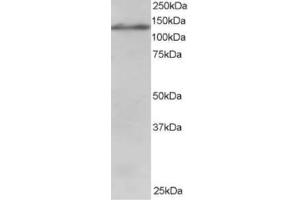 Western Blotting (WB) image for anti-Ubiquitin Specific Peptidase 11 (USP11) (C-Term) antibody (ABIN2466422) (USP11 antibody  (C-Term))