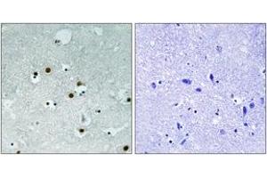 Immunohistochemistry analysis of paraffin-embedded human brain tissue, using HP1 alpha (Ab-92) Antibody. (CBX5 antibody  (AA 58-107))