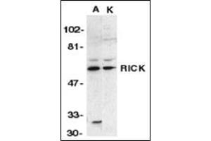 Western blot analysis of RICK in A431 (A) and K562 (K) whole cell lysate with this product at 1:1000 dilution. (RIPK2 antibody  (N-Term))