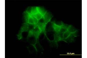 Immunofluorescence of monoclonal antibody to PCDH1 on A-431 cell. (Protocadherin 1 antibody  (AA 62-169))
