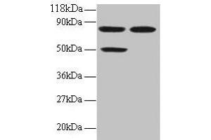 Western blot All lanes: CCL22 antibody at 2 μg/mL Lane 1: 293T whole cell lysate Lane 2: EC109 whole cell lysate Secondary Goat polyclonal to rabbit IgG at 1/15000 dilution Predicted band size: 11 kDa Observed band size: 50, 80 kDa (CCL22 antibody  (AA 25-82))