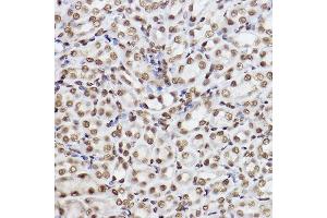 Immunohistochemistry of paraffin-embedded mouse kidney using UBE2B Rabbit mAb (ABIN7271173) at dilution of 1:100 (40x lens). (UBE2B antibody)