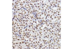 Immunohistochemistry of paraffin-embedded mouse kidney using UBE2B Rabbit mAb (ABIN7271173) at dilution of 1:100 (40x lens).