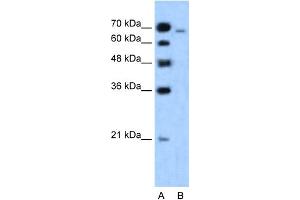 WB建议的抗-MLLT4抗体滴定：1。（Afadin抗体（N-末端））