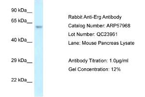 Western Blotting (WB) image for anti-ERG, ETS transcription factor (ERG) (C-Term) antibody (ABIN2787486) (ERG antibody  (C-Term))