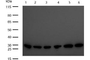 All lanes : C1QBP Rabbit mAb at 1/1k dilution Lane 1 : 3T3 whole cell lysates Lane 2 : Mouse Brain lysates Lane 3 : Mouse Kidney lysates Lane 4 : C6 whole cell lysates Lane 5 : Rat Brain lysates Lane 6 : Rat Kidney lysates Lysates/proteins at 20 μg per lane. (Recombinant C1QBP antibody)