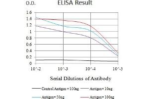Black line: Control Antigen (100 ng),Purple line: Antigen (10 ng), Blue line: Antigen (50 ng), Red line:Antigen (100 ng) (CXCR2 antibody)