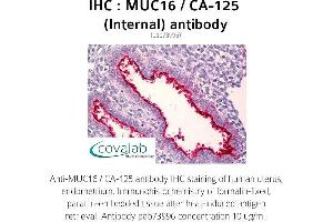 Image no. 1 for anti-Mucin 16, Cell Surface Associated (CA125) (Internal Region) antibody (ABIN1737142) (MUC16 antibody  (Internal Region))