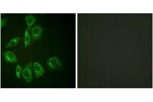 Immunofluorescence analysis of HuvEc cells, using PKC-pan (Ab-Thr497) Antibody.