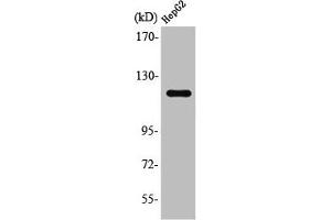 Western Blot analysis of Jurkat cells using SPT16 Polyclonal Antibody (SUPT16H antibody  (C-Term))