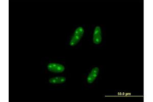 Immunofluorescence of purified MaxPab antibody to SSX5 on HepG2 cell. (SSX5 antibody  (AA 1-229))