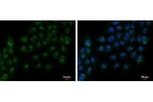 ICC/IF Image PAF49 antibody detects PAF49 protein at nucleolus by immunofluorescent analysis. (CD3EAP antibody  (Center))