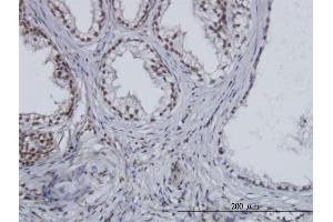 Immunoperoxidase of monoclonal antibody to ESPL1 on formalin-fixed paraffin-embedded human prostate. (Separase antibody  (AA 586-701))