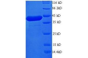 SDS-PAGE (SDS) image for Programmed Cell Death 6 (PDCD6) (AA 1-191), (full length) protein (GST tag) (ABIN1047560)