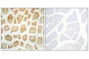 Immunohistochemistry analysis of paraffin-embedded human skeletal muscle tissue using Actin α-2/3 antibody. (ACTN3 antibody  (N-Term))