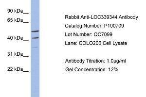 WB Suggested Anti-MYPOP  Antibody Titration: 0. (Myb-Related Transcription Factor, Partner of Profilin (MYPOP) (C-Term) antibody)