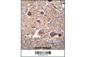 ITPKB Antibody immunohistochemistry analysis in formalin fixed and paraffin embedded human brain tissue followed by peroxidase conjugation of the secondary antibody and DAB staining. (ITPKB antibody  (N-Term))