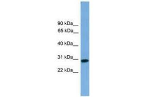Image no. 1 for anti-Regulator of Calcineurin 2 (RCAN2) (AA 71-120) antibody (ABIN6746341) (RCAN2 antibody  (AA 71-120))