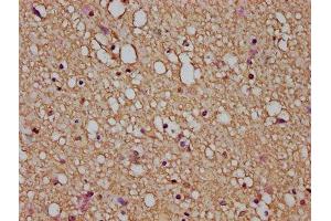 IHC image of ABIN7153853 diluted at 1:200 and staining in paraffin-embedded human brain tissue performed on a Leica BondTM system. (GFAP antibody  (AA 292-432))