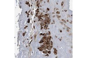 Immunohistochemical staining of human placenta with PPM1L polyclonal antibody  shows strong cytoplasmic positivity in decidual cells. (PPM1L antibody)