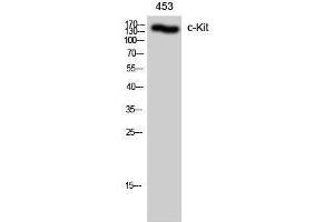 Western Blotting (WB) image for anti-Mast/stem Cell Growth Factor Receptor (KIT) (Ser71) antibody (ABIN3179954) (KIT antibody  (Ser71))