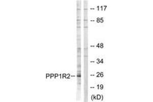 Western blot analysis of extracts from Jurkat cells, using PPP1R2 (Ab-120/121) Antibody. (PPP1R2 antibody  (AA 86-135))