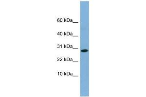 WB Suggested Anti-RPE Antibody Titration: 0. (RPE antibody  (Middle Region))