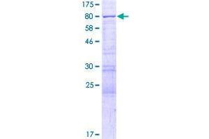 YTHDF2 Protein (AA 1-579) (GST tag)